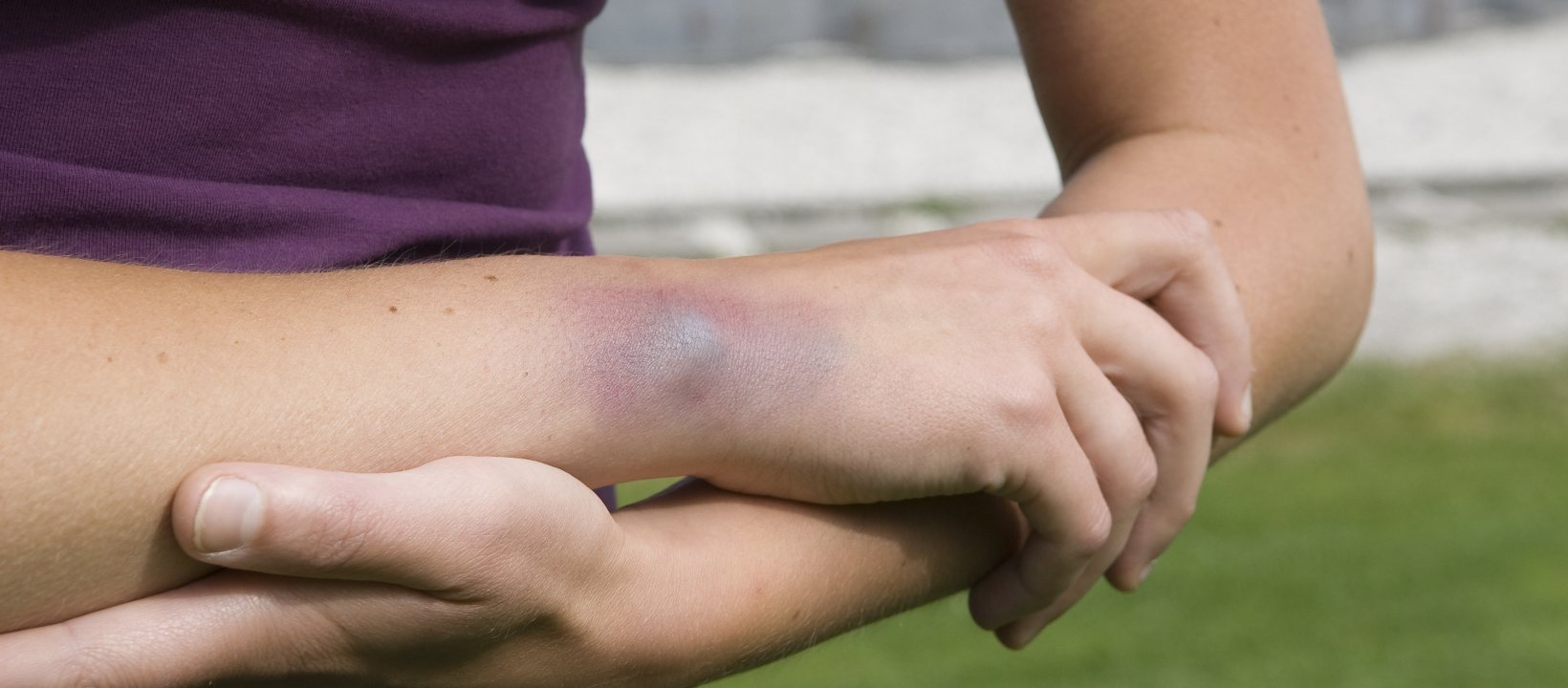 Outdoor EHBO
