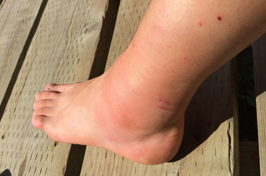 voet-600x398.jpg voet-600x398.jpg